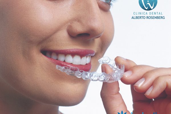 Alinea tu sonrisa sin dolores ni aparatos molestos