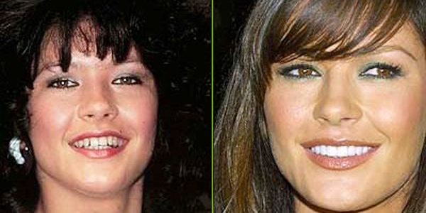 ¿Cuál es el secreto de las sonrisas de Hollywood? ¡Te decimos cómo obtenerlas!