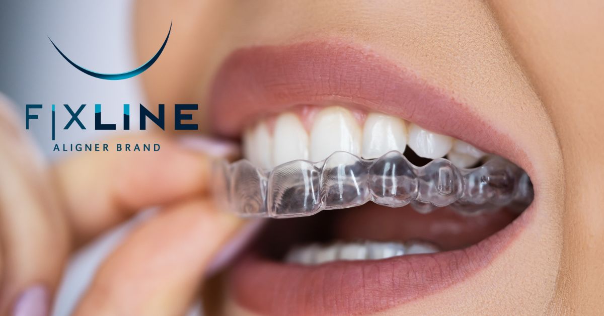 Cómodo, estético y más económico: alinea tu sonrisa con FixLine